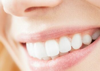 Comment blanchir une couronne dentaire ?