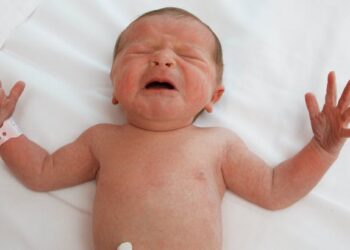 Comment calmer le réflexe de Moro ?