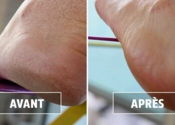 Comment éviter la corne sous les pieds ?