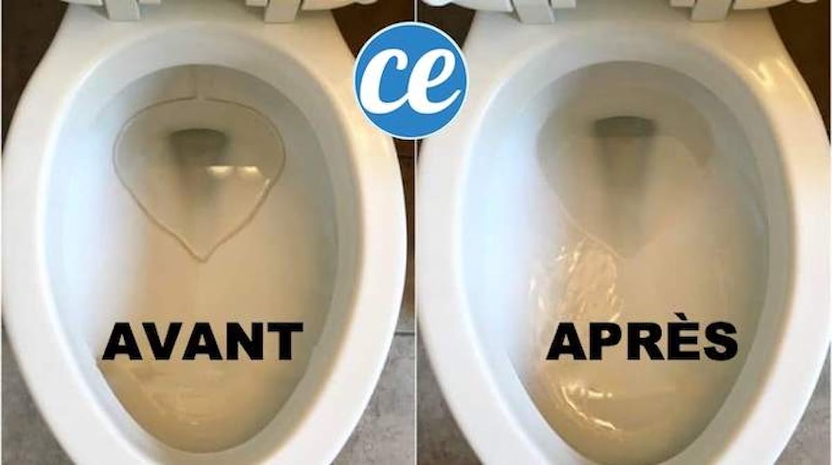 Comment Faire Pour Avoir La Cuvette Des Wc Blanc