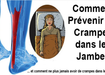 Comment ne plus avoir les jambes marbre ?