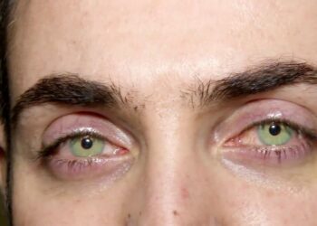 Comment on appelle les yeux qui change de couleur ?