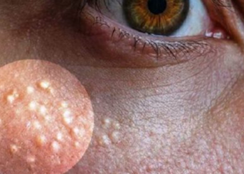 Comment percer un grain de milium ?