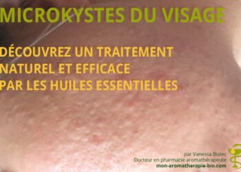 Comment reconnaître un Microkyste ?