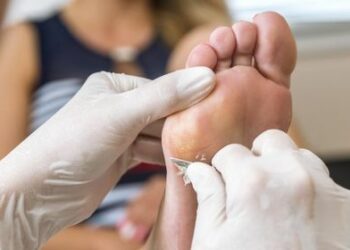 Comment reconnaître un cor au pied ?