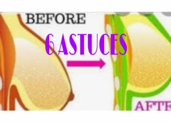 Comment redresser sa plante ?