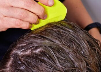 Comment se débarrasser du rouge dans les cheveux ?