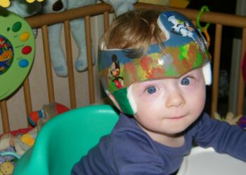 Comment soigner la tête plate ?