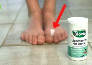 Comment soigner une mycose au pied rapidement ?