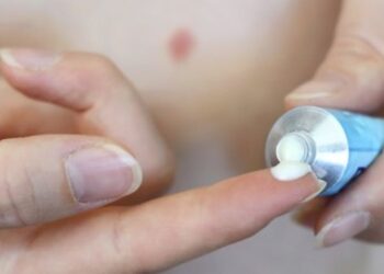 Comment soigner une piqûre de bourdon ?