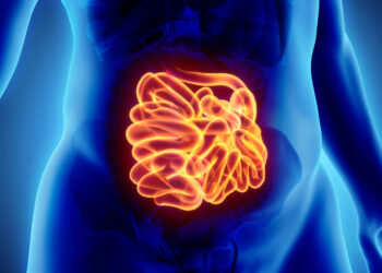 Est-ce que le cancer de l'intestin se soigne ?