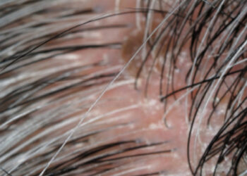 Est-ce que le lin repousse ?