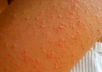 Est-ce que le rouge va avec tout ?