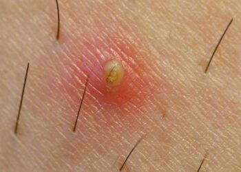 Est-ce que les opilions ont des poils ?