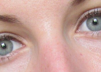 Est-ce que les yeux gris sont rare ?