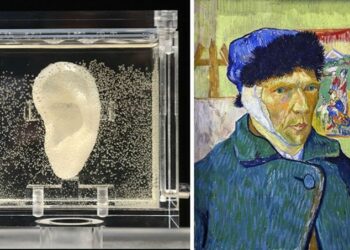 Où est l'oreille de Van Gogh ?