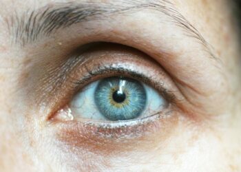 Pourquoi les Turcs ont les yeux bleus ?