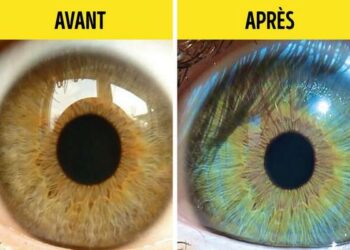 Pourquoi mes yeux ont changé de couleur ?