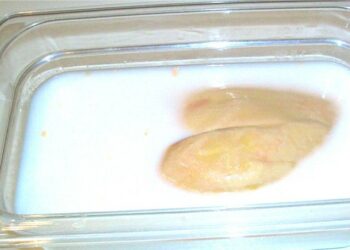 Pourquoi mettre du chaud sur le foie ?