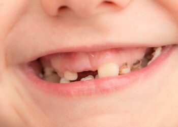 Pourquoi ne pas jeter les dents de lait ?