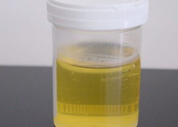 Pourquoi une urine mousseuse ?