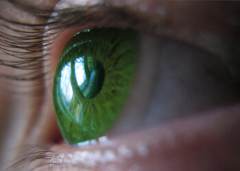 Pourquoi yeux pers changent couleur ?