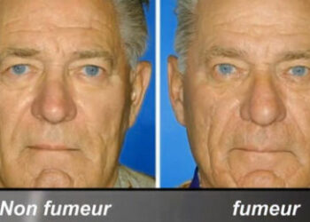 Quel est la différence entre Avent et avant ?