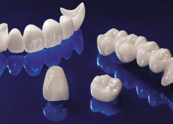 Qu'est-ce qu'une couronne Ceramo céramique ?