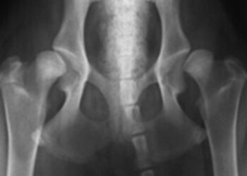 Qu'est-ce qu'une dysplasie chez le chien ?